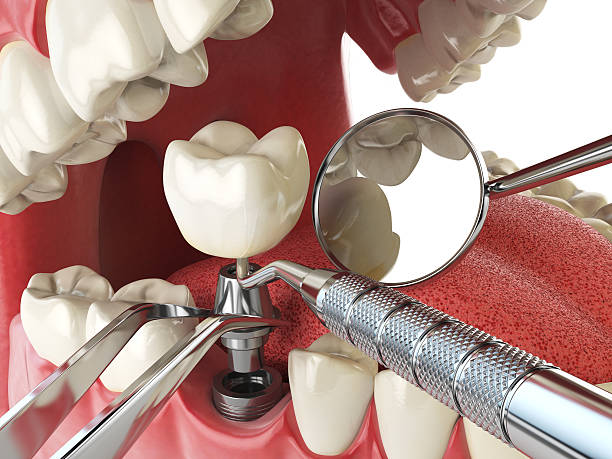 Best Pediatric Emergency Dentist in Aledo, IL
